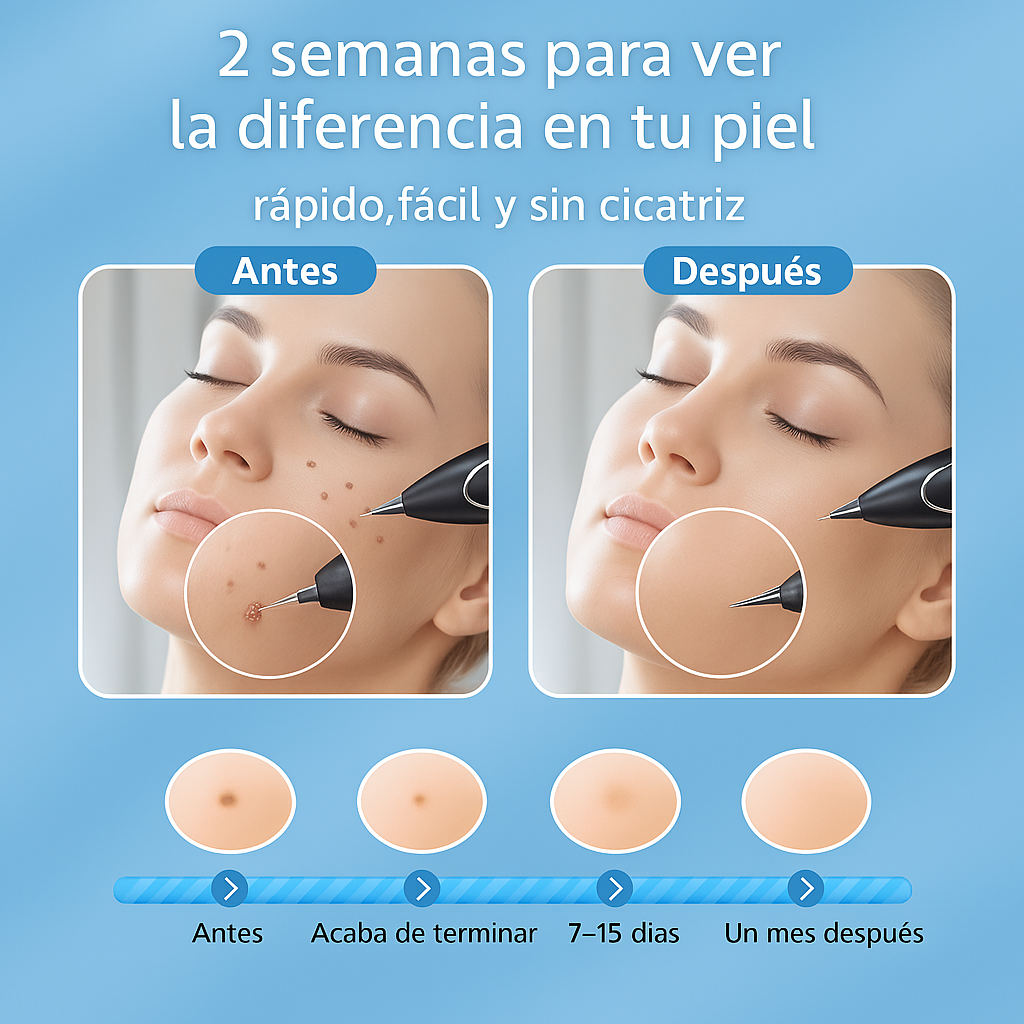 ¡DI ADIOS A LAS VERRUGAS DESDE CASA! BioCauter® 💥Cauterizador de verrugas + ENVIO GRATIS 🎁