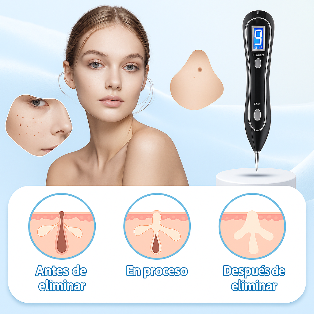 ¡DI ADIOS A LAS VERRUGAS DESDE CASA! BioCauter® 💥Cauterizador de verrugas + ENVIO GRATIS 🎁