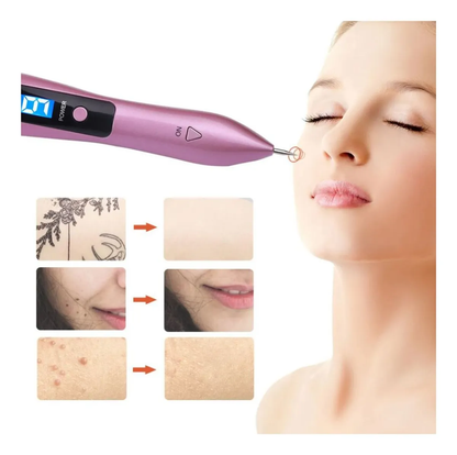 ¡DI ADIOS A LAS VERRUGAS DESDE CASA! BioCauter® 💥Cauterizador de verrugas + ENVIO GRATIS 🎁